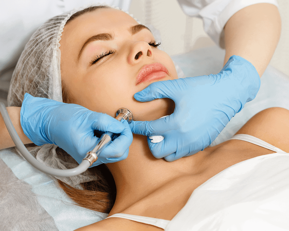 Microdermabrasion 1