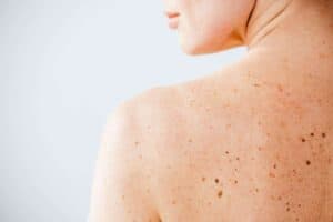 Skin Health Img 300x200
