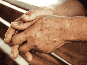 Age Spots Large 0006 AdobeStock 81585490 300x225
