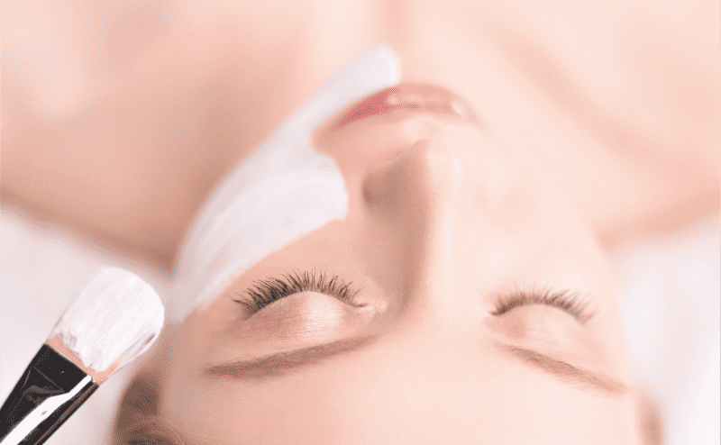 How To Get Rid Of Acne Scars With Chemical Peels E1653644932386