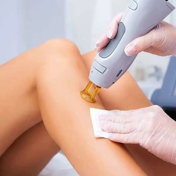 laser hair removal near me