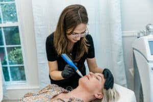 Microneedling 4 300x200