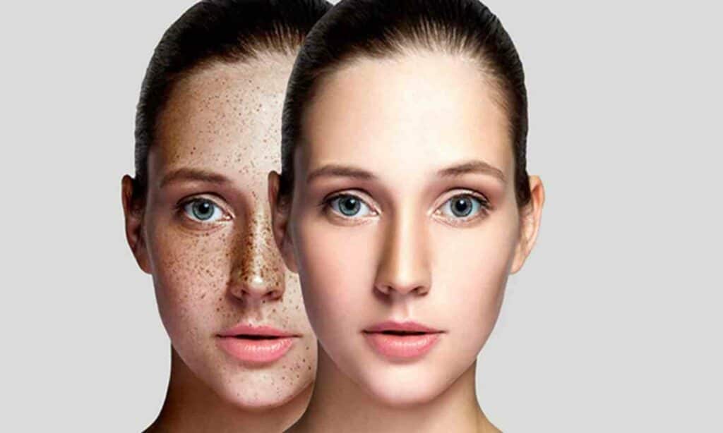 Patient Information Dermatology Stratum Dermatology Clinic