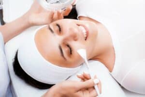 Chemical Peel 300x200