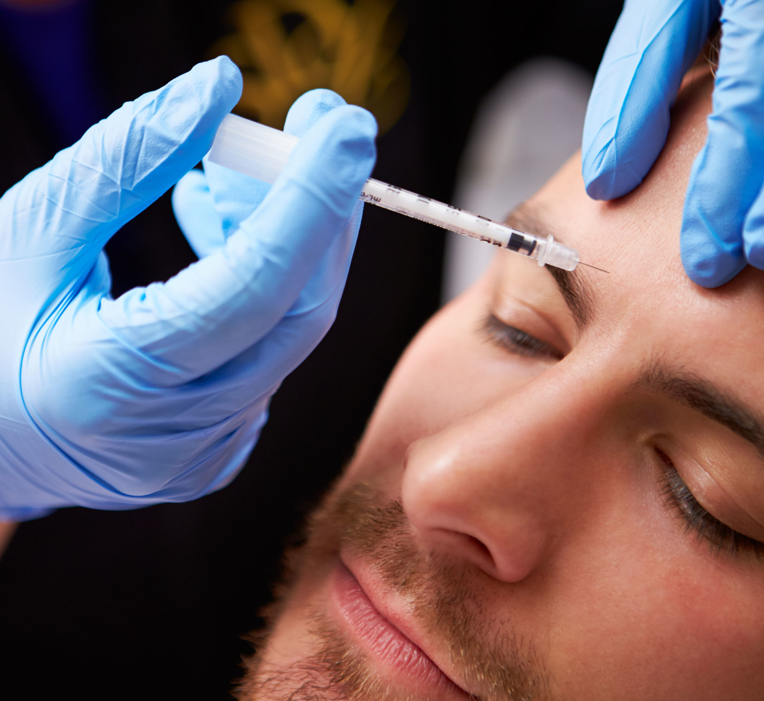 Dermal Fillers