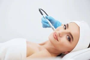 Microdermabrasion 300x200