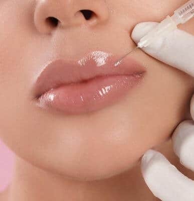 Lip Fillers