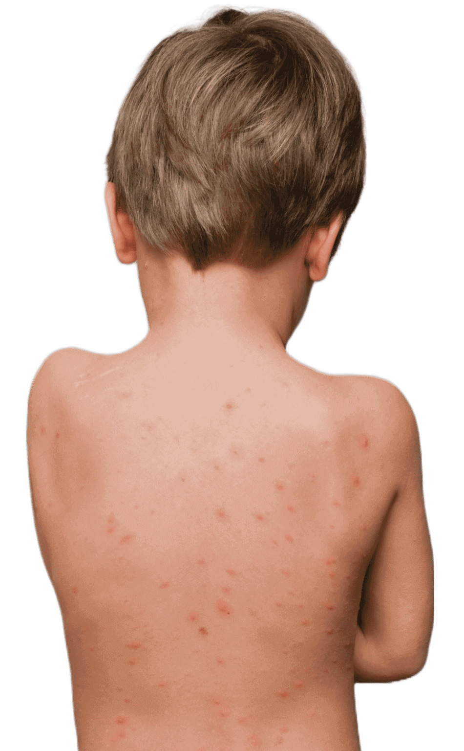 Childrens Dermatologist