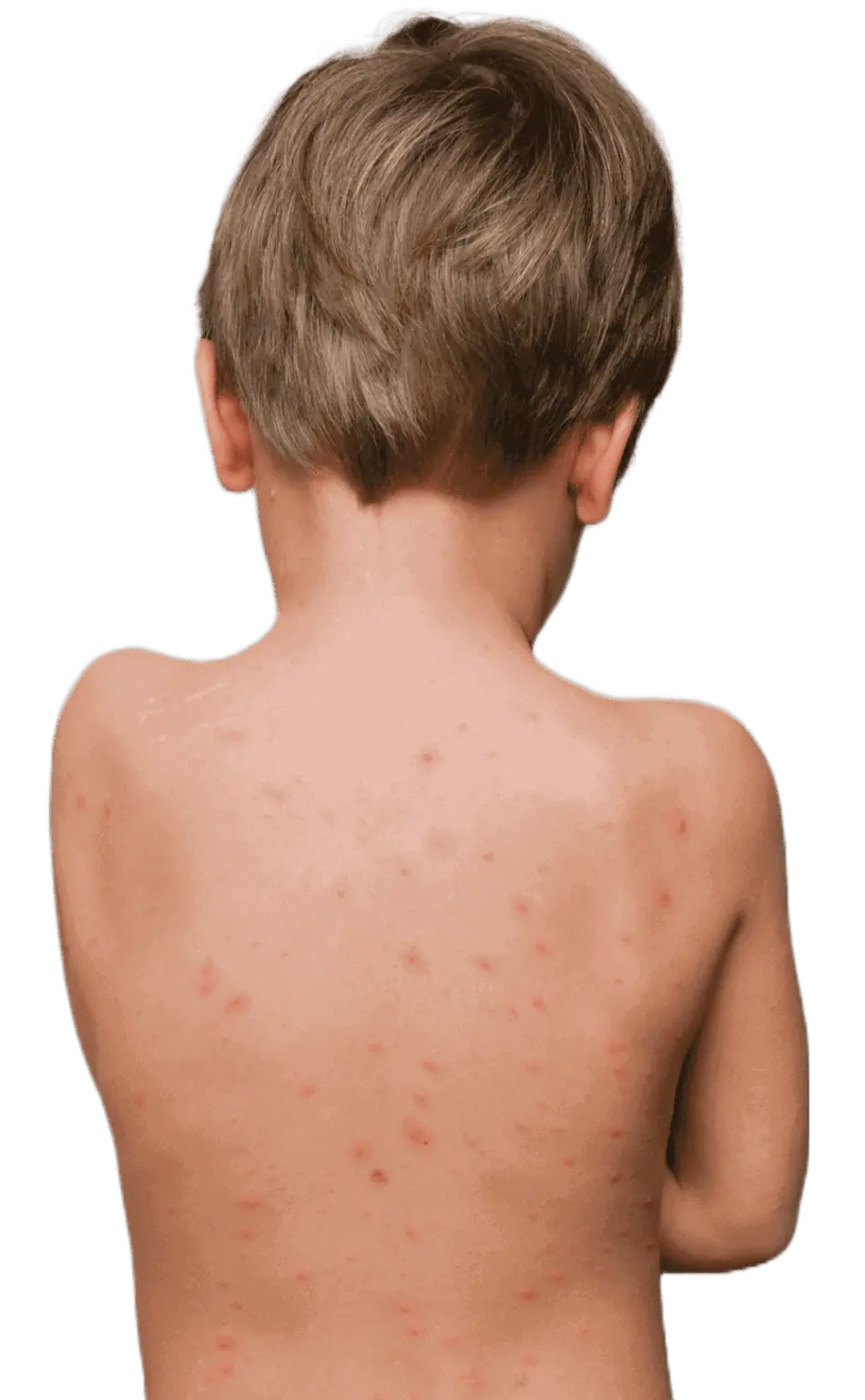 Childrens Dermatologist