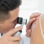 mole check