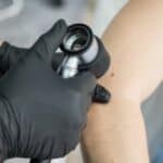 mole check Cheltenham