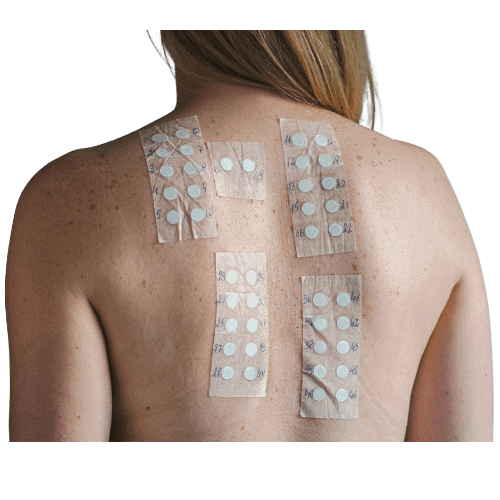 SKIN ALLERGY PATCH TEST