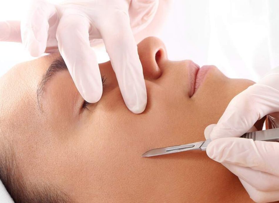 dermaplaning-2