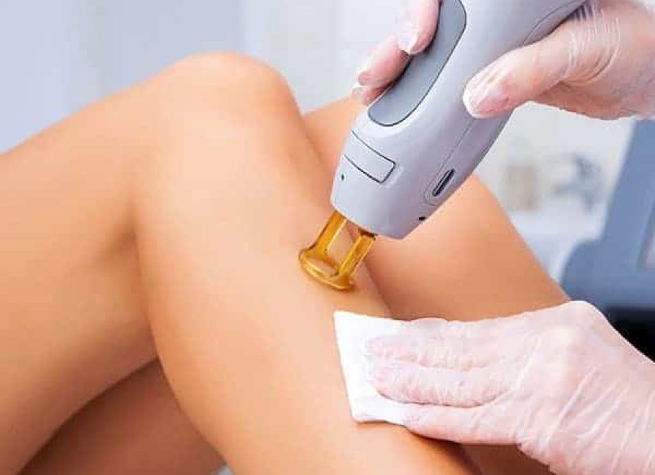 laser hair removal near me